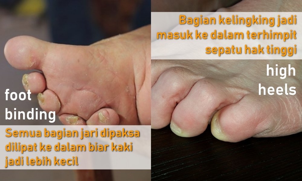 Antara Foot Binding dan High Heels, Perempuan Masih Saja Menyiksa