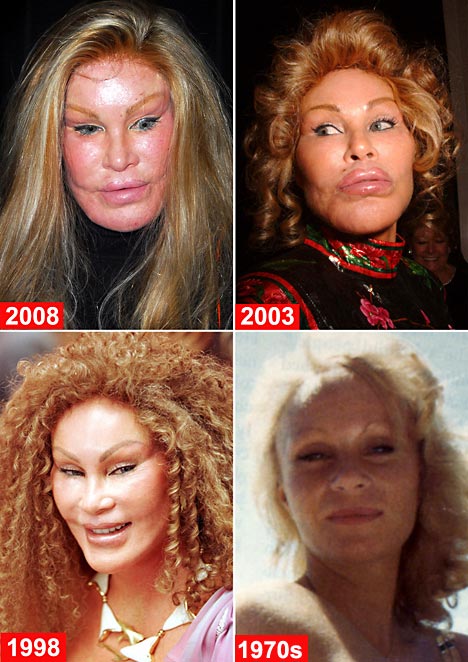 Jocelyn Wildenstein Sebelum dan Sesudah Operasi